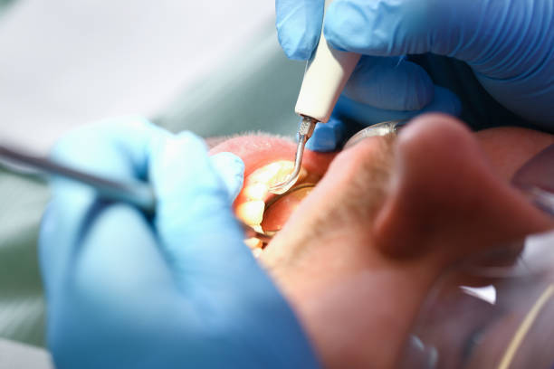 Best Emergency Treatment for Toothache in Charleston, IL