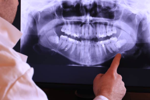 Best Emergency Treatment for Toothache in Charleston, IL