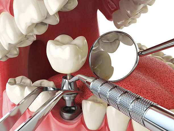 Best Emergency Orthodontic Repairs in Charleston, IL